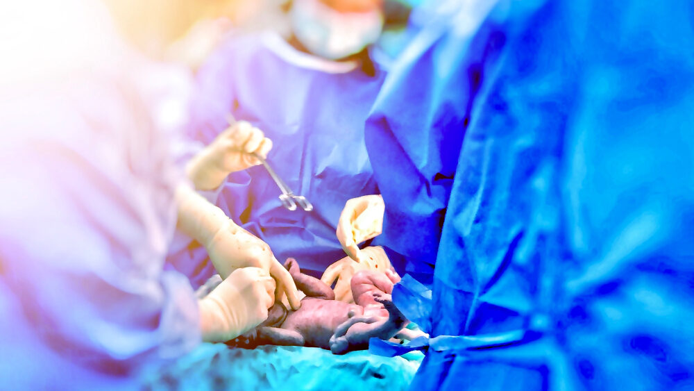 The Link Between Delayed C-Sections and Birth Injuries