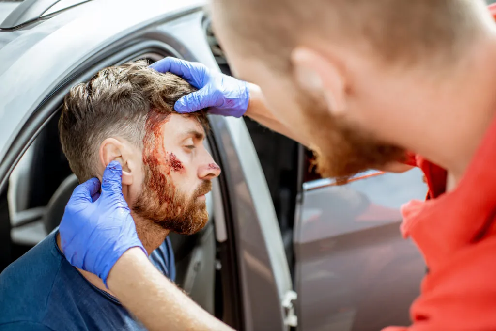Traumatic Brain Injury in Florida Car Accidents