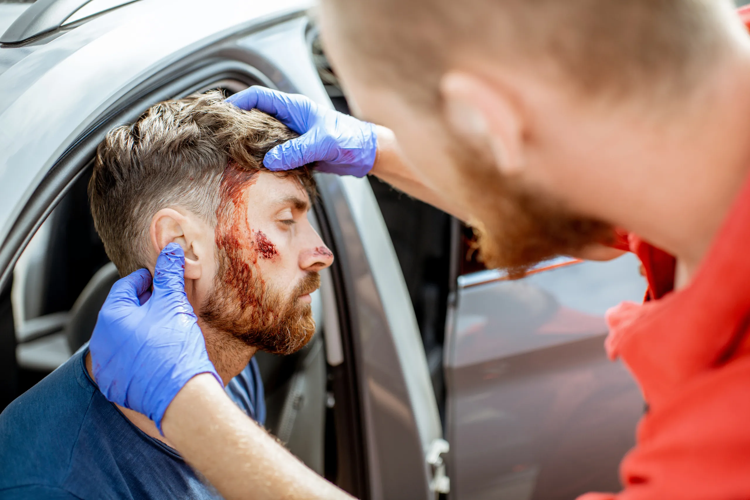 Traumatic Brain Injury in Florida Car Accidents